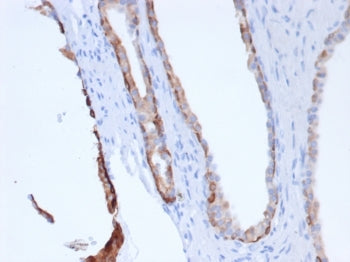 Pan Cytokeratin Antibody Cocktail