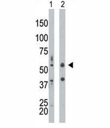 PKR antibody used in western blot to detect PRKR/PKR in mouse liver tissue lysate (Lane 1) and HepG2
