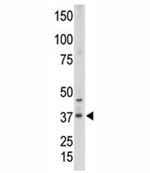 Western blot testing of CDX2 antibody and human placenta tissue lysate. Predicted molecular weight: 