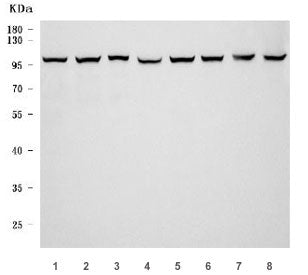 TER ATPase Antibody / VCP / Valosin-containing protein