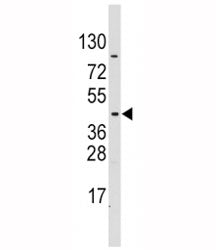 Western blot analysis of PDK4 antibody and CEM lysate. Expected/observed molecular weight ~46 kDa.