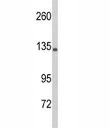 Complement C5 Antibody