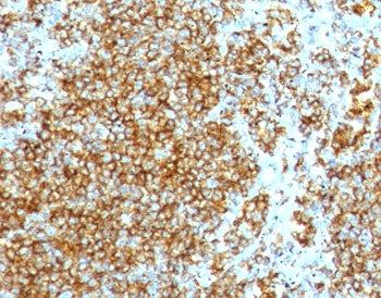 CD44 Antibody / HCAM