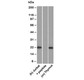 Western blot testing of human Jurkat lysate in the absence and presence of immunizing peptide, and m