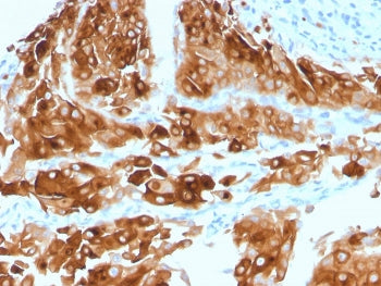 Uroplakin 1A Antibody / UPK1A