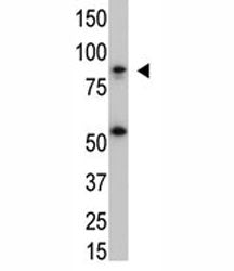 The IKK beta antibody used in western blot with SK-BR3 cell lysate. Predicted molecular weight ~87 k