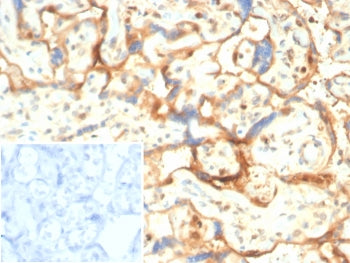 IHC staining of FFPE human placental tissue with S100A11 antibody (clone S100A11/7393). Inset: PBS u