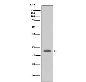 Western blot testing of human A431 cell lysate with BCL2L11 antibody. Predicted molecular weight: 12