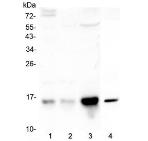 Western blot testing of human 1) COLO-320, 2) placenta, 3) HepG2 and 4) mouse brain lysate with Cyst