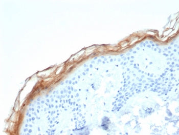 IHC staining of FFPE human skin tissue with KLK7 antibody (clone KLK7/4693). HIER: boil tissue secti