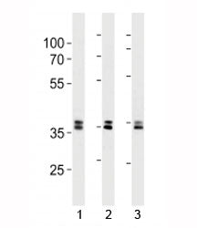 UCH37 Antibody (UCHL5)