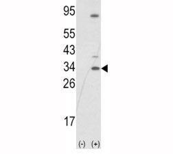 Western blot analysis of SNAI1 antibody and 293 cell lysate (2 ug/lane) either nontransfected (Lane 