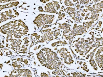 VDAC1 Antibody
