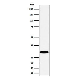 Western blot testing of human Jurkat cell lysate with Thiopurine methyltransferase antibody. Predict