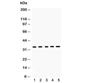 CCS Antibody / Copper chaperone for superoxide dismutase