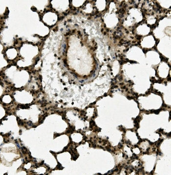 IHC staining of FFPE rat lung with AHR antibody. HIER: boil tissue sections in pH8 EDTA for 20 min a