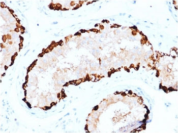 IHC testing of FFPE human testis stained with MAGEA4 antibody. Required HIER: boiling tissue section