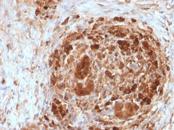 FTH Antibody / Ferritin heavy chain