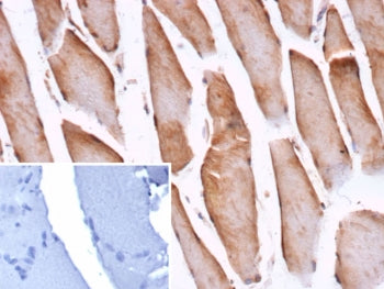 IHC staining of FFPE human skeletal muscle tissue with Cofilin 2 antibody (clone CFL2/9963). Inset: 