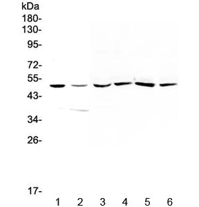 Western blot testing of 1) human HepG2, 2) human A549, 3) rat liver, 4) rat kidney, 5) mouse liver a