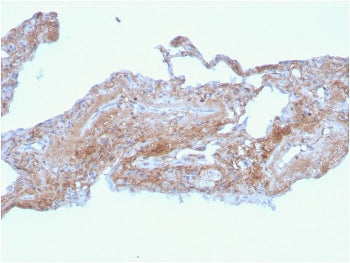FN1 Antibody / Fibronectin