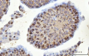 YBX2 Antibody / Y-box-binding protein 2 / MSY2