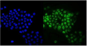 Immunofluorescent staining of FFPE human A431 cells with RAB9A antibody (green) and DAPI nuclear sta