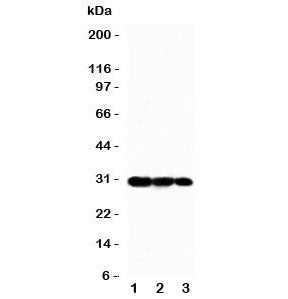 Western blot testing of TRAF3 antbody and Lane 1: Recombinant human protein 5ng; 2: 2.5ng; 3: 1.25ng