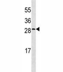 CRP Antibody (C-Reactive Protein)