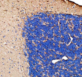 IHC staining of FFPE zebrafish brain tissue with Zebrafish Gap43 antibody. HIER: boil tissue section