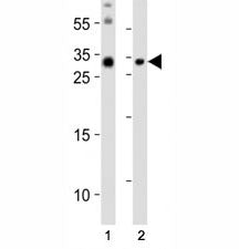 Olig3 Antibody