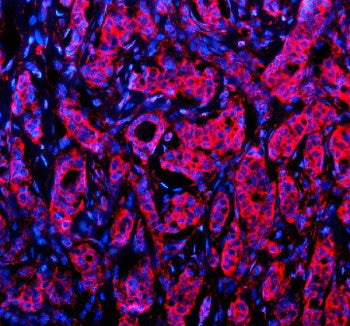 Immunofluorescent staining of NID1 using anti-NID1 antibody (red). NID1 was detected in a paraffin-e