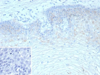 IHC staining of FFPE human esophagus tissue with recombinant Tripartite motif-containing protein 29 