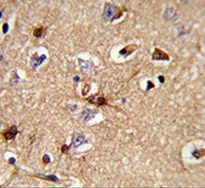 IHC testing of FFPE human brain tissue with PRDX6 antibody. HIER: steam section in pH6 citrate buffe