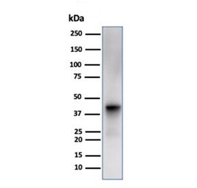 Glutamine Synthetase Antibody / GLUL