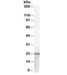 Western blot testing of mouse kidney lysate with NGAL antibody at 2ug/ml. Predicted molecular weight