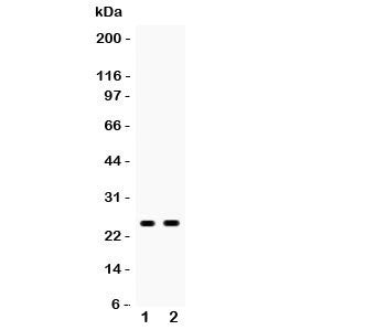 Western blot testing of PSCA antibody and Lane 1: rat stomach; 2: mouse stomach; Predicted size: 13K