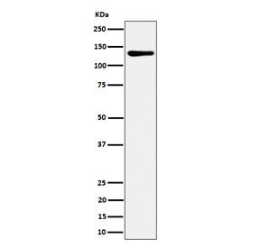 Western blot testing of human HeLa cell lysate with MCM2 antibody. Commonly observed at 100-130 kDa.