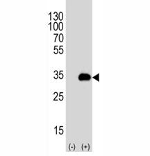 Western blot analysis of ATG-5 antibody and 293T cell lysate either nontransfected (Lane 1) or trans