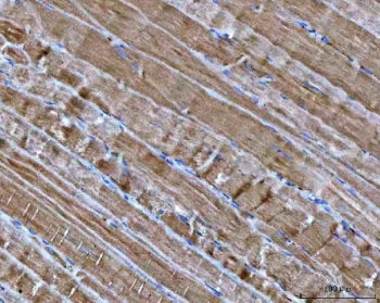 IHC staining of FFPE human skeletal muscle tissue with NDUFA1 antibody. HIER: boil tissue sections i