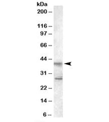 Western blot testing of Jurkat lysate with SCAP2 antibody at 0.5ug/ml. Both the expected 40 kDa and 