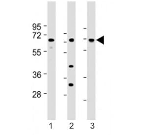 Western blot testing of LAT2 antibody at 1:1000: Lane 1) human brain, 2) kidney and 3) liver lysate.