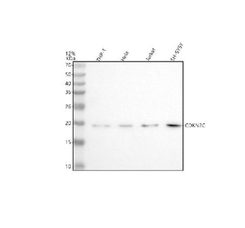Western blot analysis of CDKN2C using anti-CDKN2C antibody. Lane 1: human THP-1 whole cell lysates, 