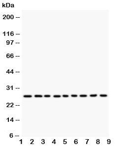 Western blot testing of Kallikrein 6 antibody and human lysate samples: 1) MCF-7; 2) HeLa; 3) MM231;