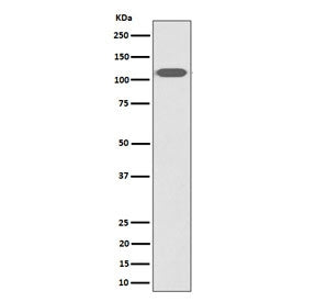 Western blot testing of human HeLa cell lysate with ZHX2 antibody. Predicted molecular weight ~92 kD