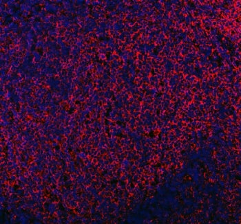 Immunofluorescent staining of FFPE human tonsil tissue with MRC1 antibody (red) and DAPI nuclear sta