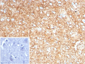 GFAP Antibody / Glial Fibrillary Acidic Protein