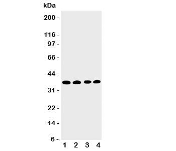 Western blot testing of EIF2S1 antbody; Lane 1: COLO320; 2: CEM; 3: Raji; 4: HT1080 cell lysate. Pre