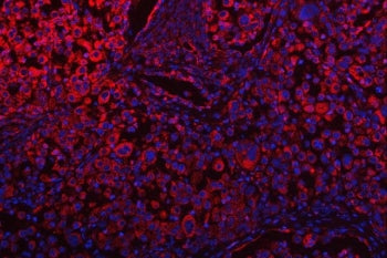 OSGIN1 Antibody / Oxidative stress-induced growth inhibitor 1 / BDGI / OKL38