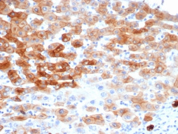 IHC staining of FFPE human colon tissue with recombinant KRT8 antibody (clone rKRT8/6471). HIER: boi